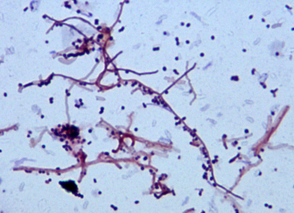 Streptomyces albus - talajbaktérium